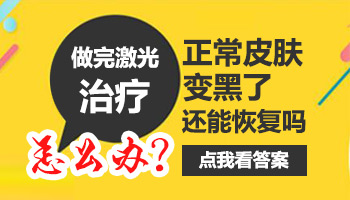 白斑照308正常皮肤变黑了怎么办