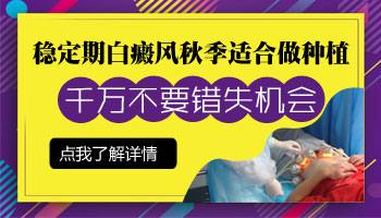 立秋后治疗白癜风用什么方法好