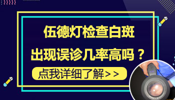 伍德灯照了一下白斑就说是白癜风准确吗