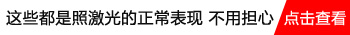 白斑照308正常皮肤变黑了怎么办