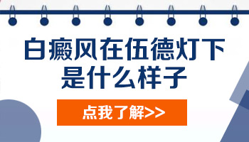 伍德氏灯检查脸上白点是亮白色怎么回事