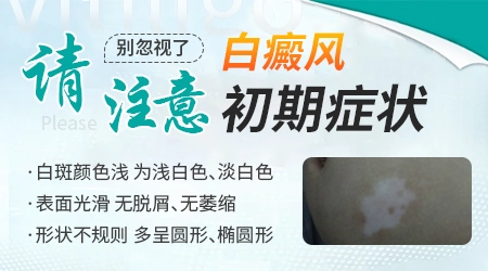 白癜风被误诊的危害-白癜风误诊危害大，正确诊断至关重要