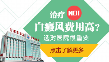 一个光斑有多大 激光照指甲盖大白癜风多少钱
