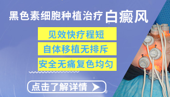 立秋后天气转凉白癜风做黑色素种植效果好吗