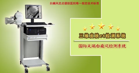 白癜风什么诊断技术比较好
