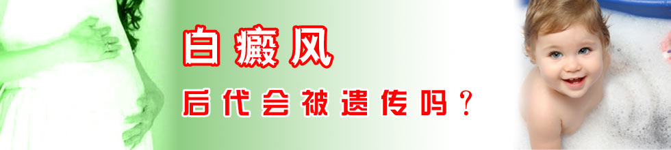 白癜风会不会隔代遗传呢?