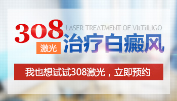 白癜风做308激光一周会有好转吗