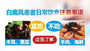 长白癜风有什么需要忌口的食物吗