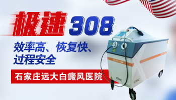 白癜风照308激光后好像越来越大怎么办