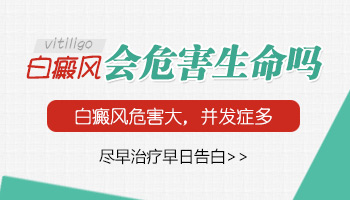 检测白斑和白癜风的区别一清二楚