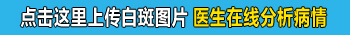 白癜风照几次308激光能看到效果