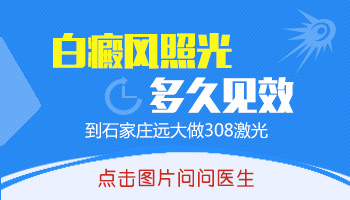 白癜风照几次308激光能看到效果