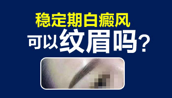 白癜风和白斑癣傻傻分不清楚从4个方面，准确将二者区分
