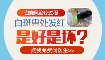 宝宝腰部白癜风照光后有点红怎么回事