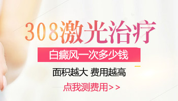 白癜风做一次308激光大概花多少钱