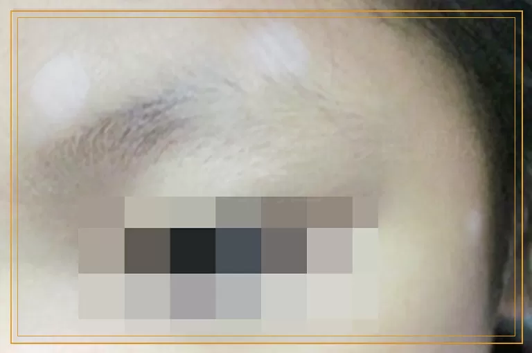 做什么检查能够确诊白癜风的病因