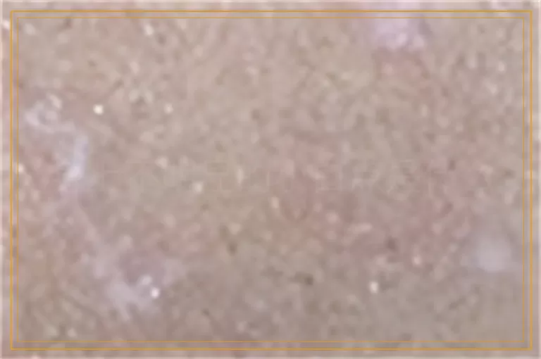 身上不明显的小白点是什么