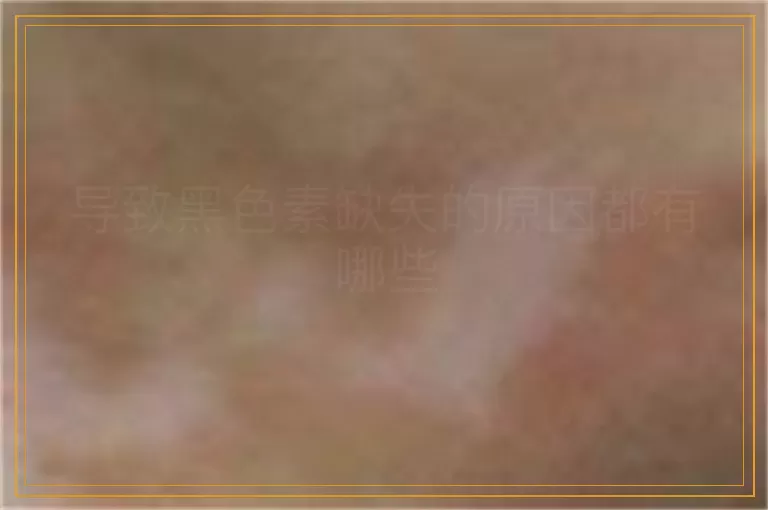 导致黑色素缺失的原因都有哪些