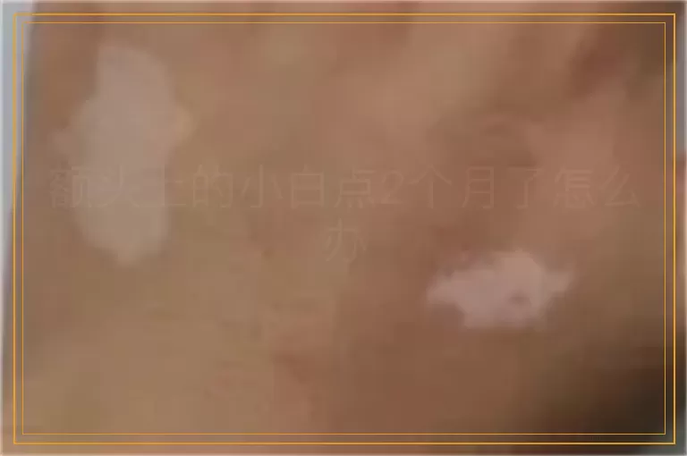 额头上的小白点2个月了怎么办