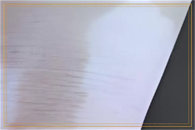 一旦得了白癜风是不是就永远跟着你了