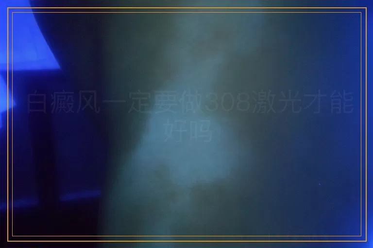 白癜风一定要做308激光才能好吗