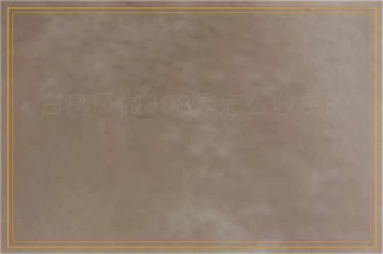 白癜风做308是怎么收费的