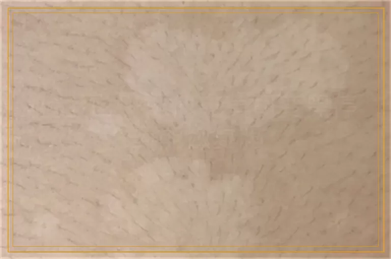 脸上白斑抹他克莫司变黑停药能恢复吗