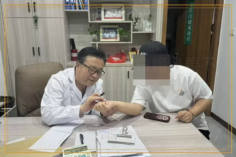 伍德灯发现隐性白癜风要不要照光治