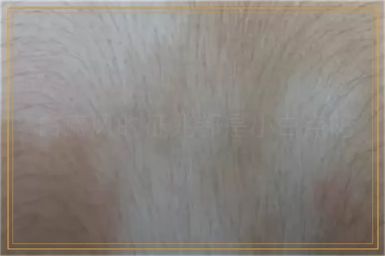 白癜风的征兆都是小白点吗