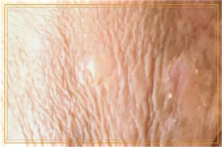 青少年手上出现白色斑点怎么办