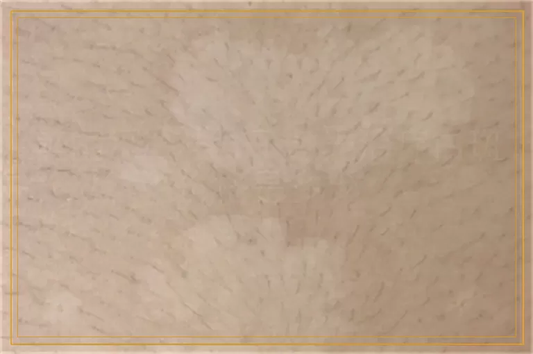 美国308准分子激光治疗白斑价格是多少