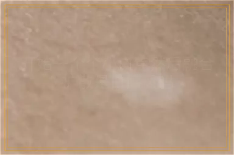 开始一个个小白点然后融合扩散是白癜风吗