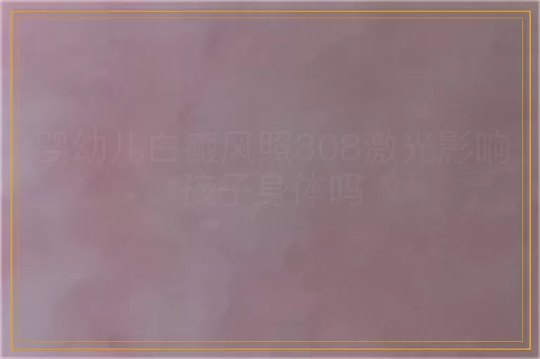 婴幼儿白癜风照308激光影响孩子身体吗
