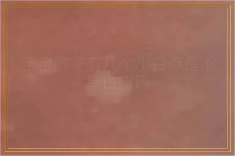 宝宝脖子有几个小白点是不是白癜风