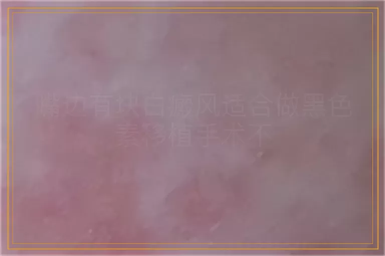 嘴边有块白癜风适合做黑色素移植手术不