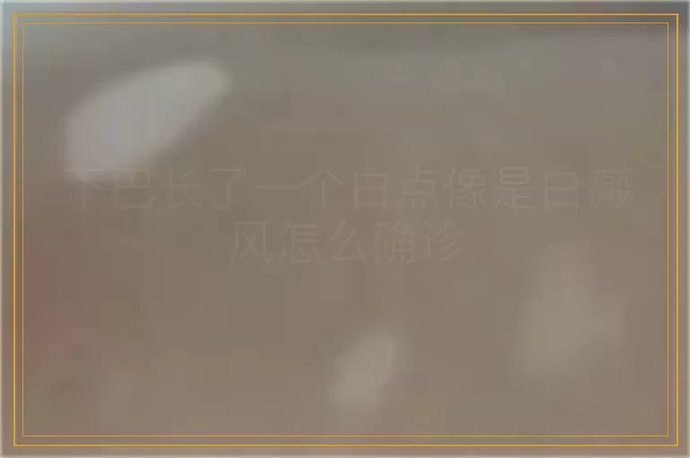 下巴长了一个白点像是白癜风怎么确诊