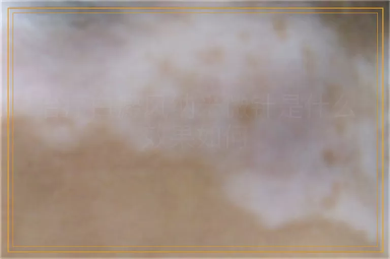 治疗白癜风纳米微针是什么效果如何