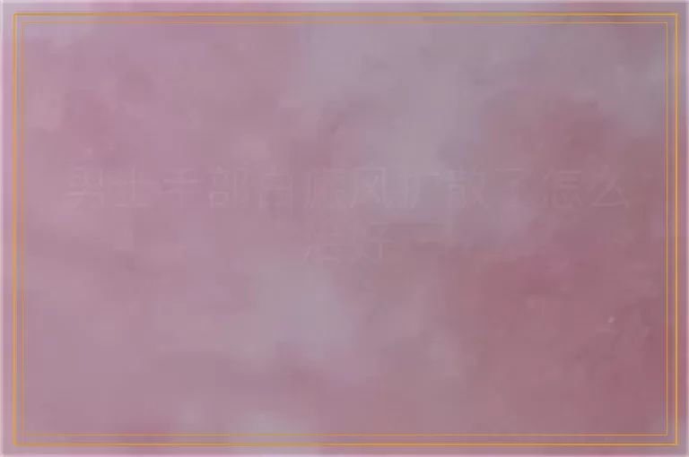 男士手部白癜风扩散了怎么治好