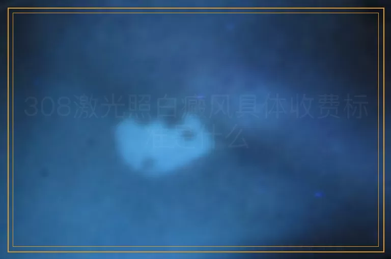 308激光照白癜风具体收费标准是什么