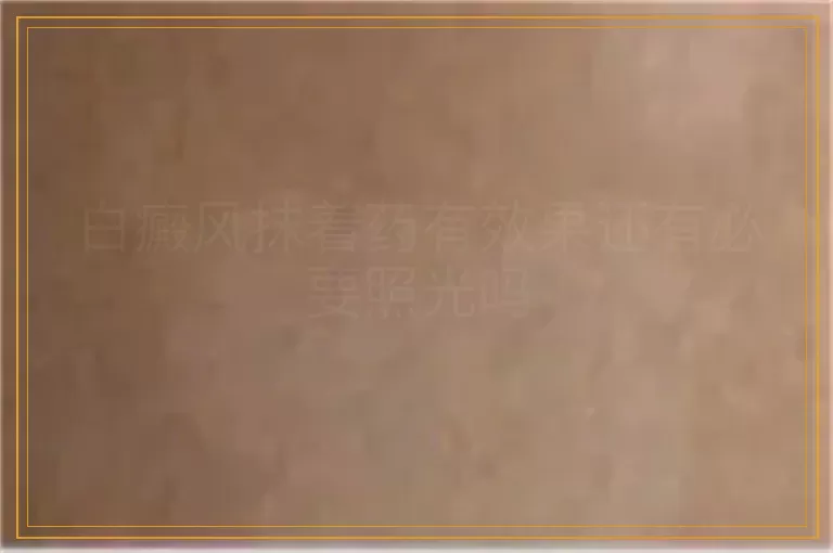 白癜风抹着药有效果还有必要照光吗
