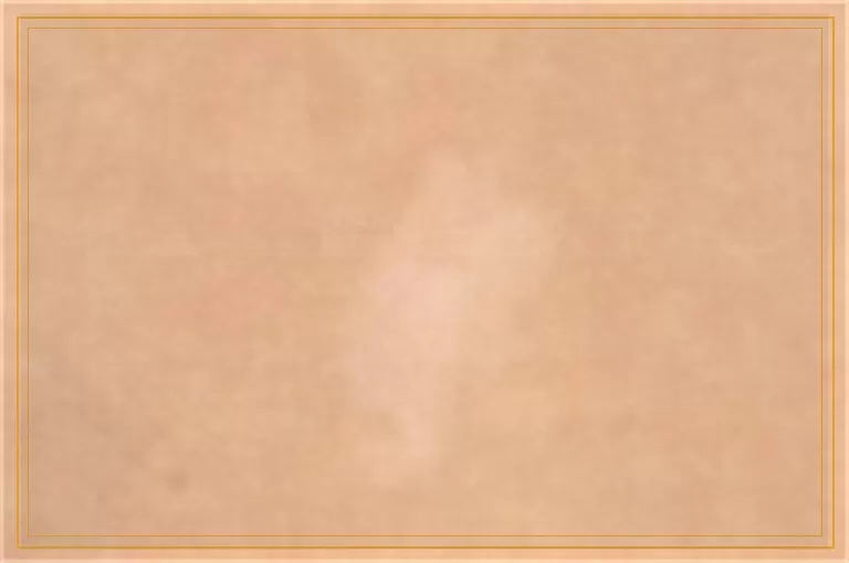 伍德灯检查纯白色荧光什么意思