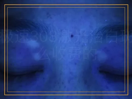 进口极速308激光治白斑是怎么收费的