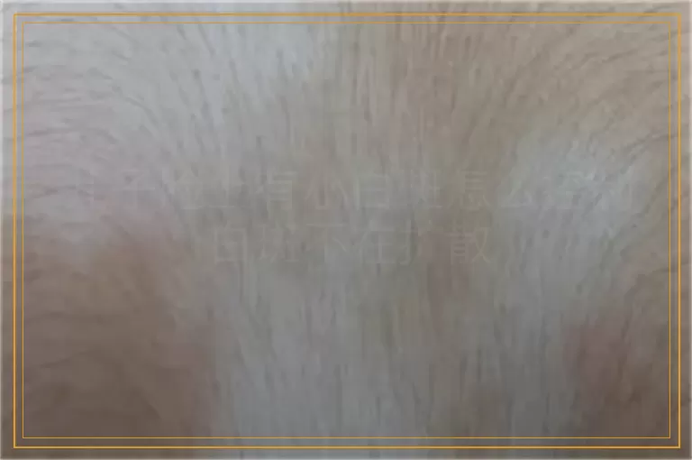 儿子脸上有小白斑怎么控制白斑不在扩散
