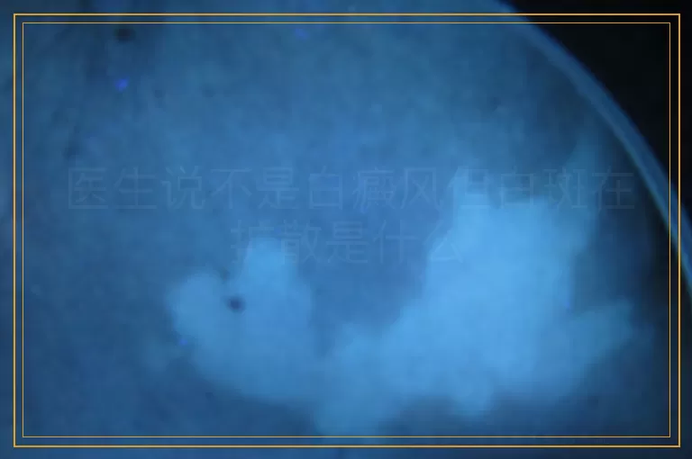 医生说不是白癜风但白斑在扩散是什么