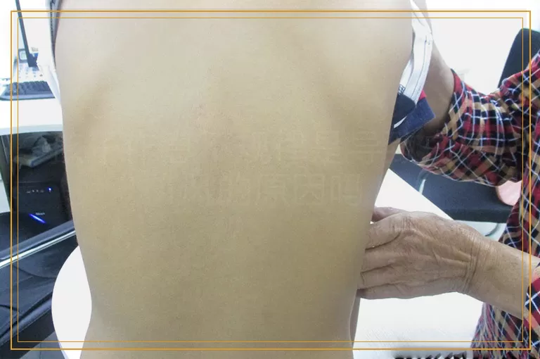 孩子作息不规律是导致白癜风的原因吗