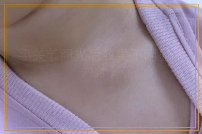 手关节照光后效果不明显是为什么