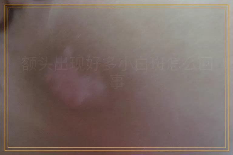 额头出现好多小白斑怎么回事