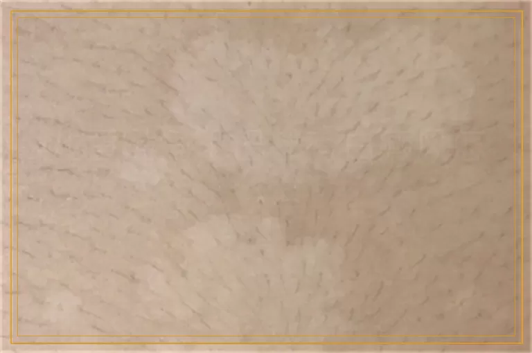 儿童嘴角下巴都有白癜风怎么治