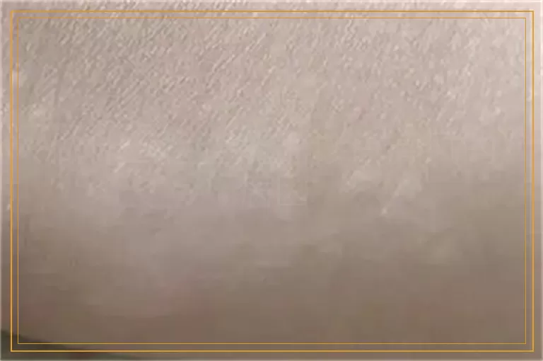 做什么检查能确诊白癜风的病因