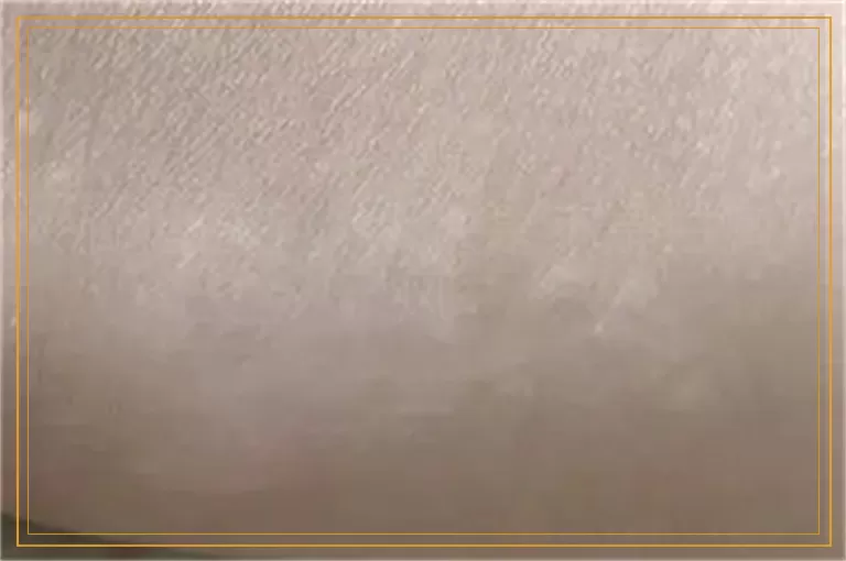 脚指白了一大块是不是白癜风